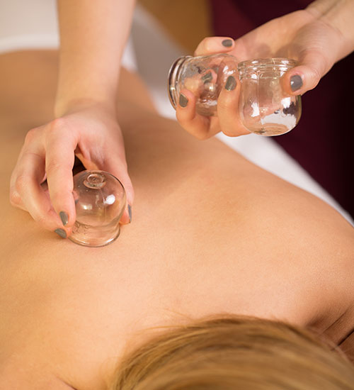 Vivo Salon and Spa Cupping Therapy